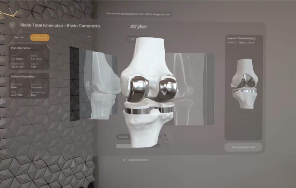 كيف يمكن لنظارة آبل Vision Pro المساعدة في تطوير مجال الرعاية الصحية؟