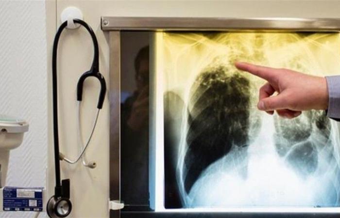 العلم يقترب من التغلب على أخطر مرض في العالم.. اليكم التفاصيل