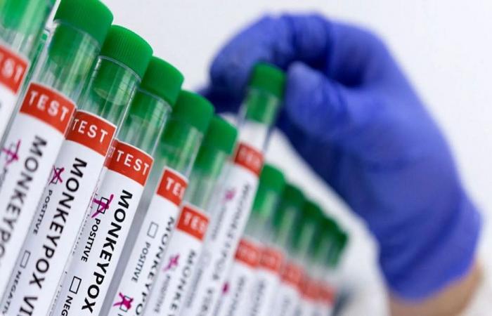 اكتشاف إصابتين بجدري القردة في روسيا