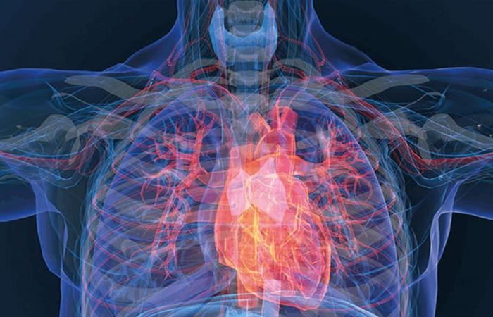 دراسة: علاج مكثف للكوليسترول يخفض النوبات القلبية بالثلث