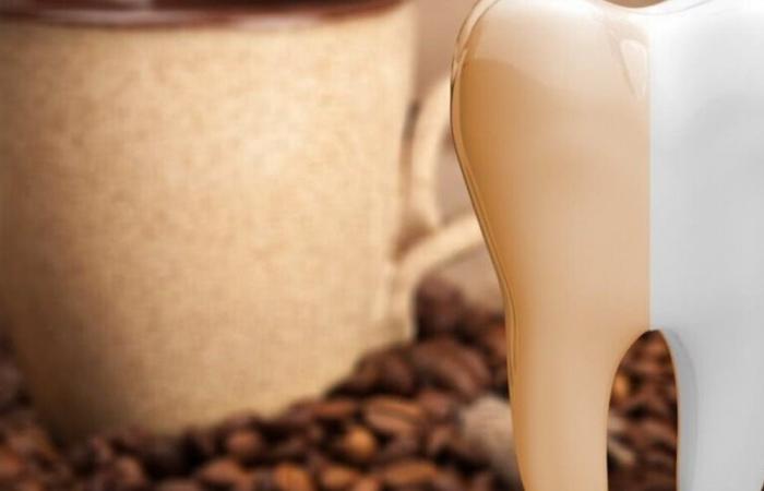 خطأ يومي مع القهوة يسرّع تصبّغ الأسنان... تجنّبه!