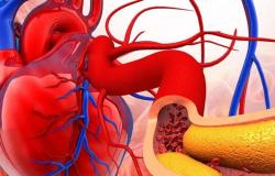 دون تدخل معقد.. تقنية جديدة لفحص شرايين القلب